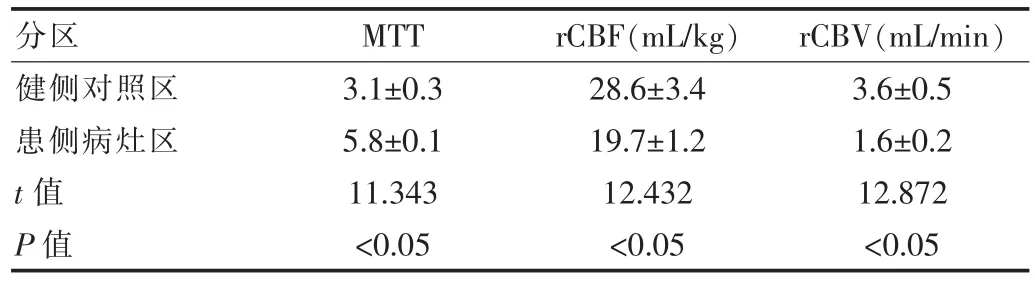 ct全脑灌注成像在脑血管病变中的临床价值